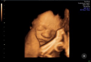 What a cutie! Techie 4D Baby!